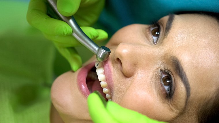 Chipped Tooth Repair - AZ Dentist